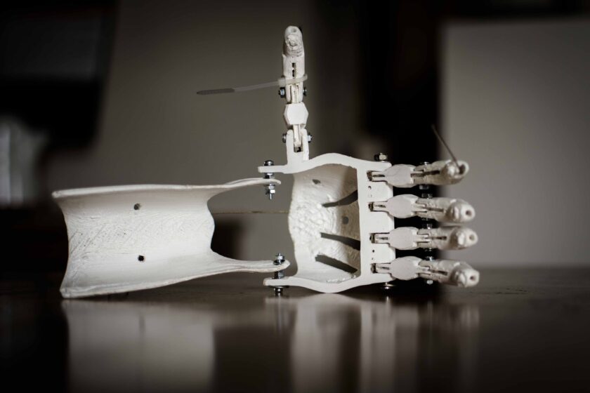 l’immagine rappresenta una protesi creata con una stampante 3d.