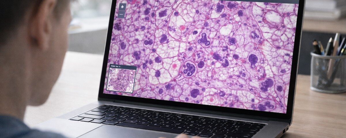 Microscopio virtuale utilizzato su laptop per osservare cellule